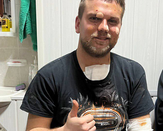 Журавлев: Бандеровцы, обстрелявшие гостиницу, будут уничтожены в ближайшее время